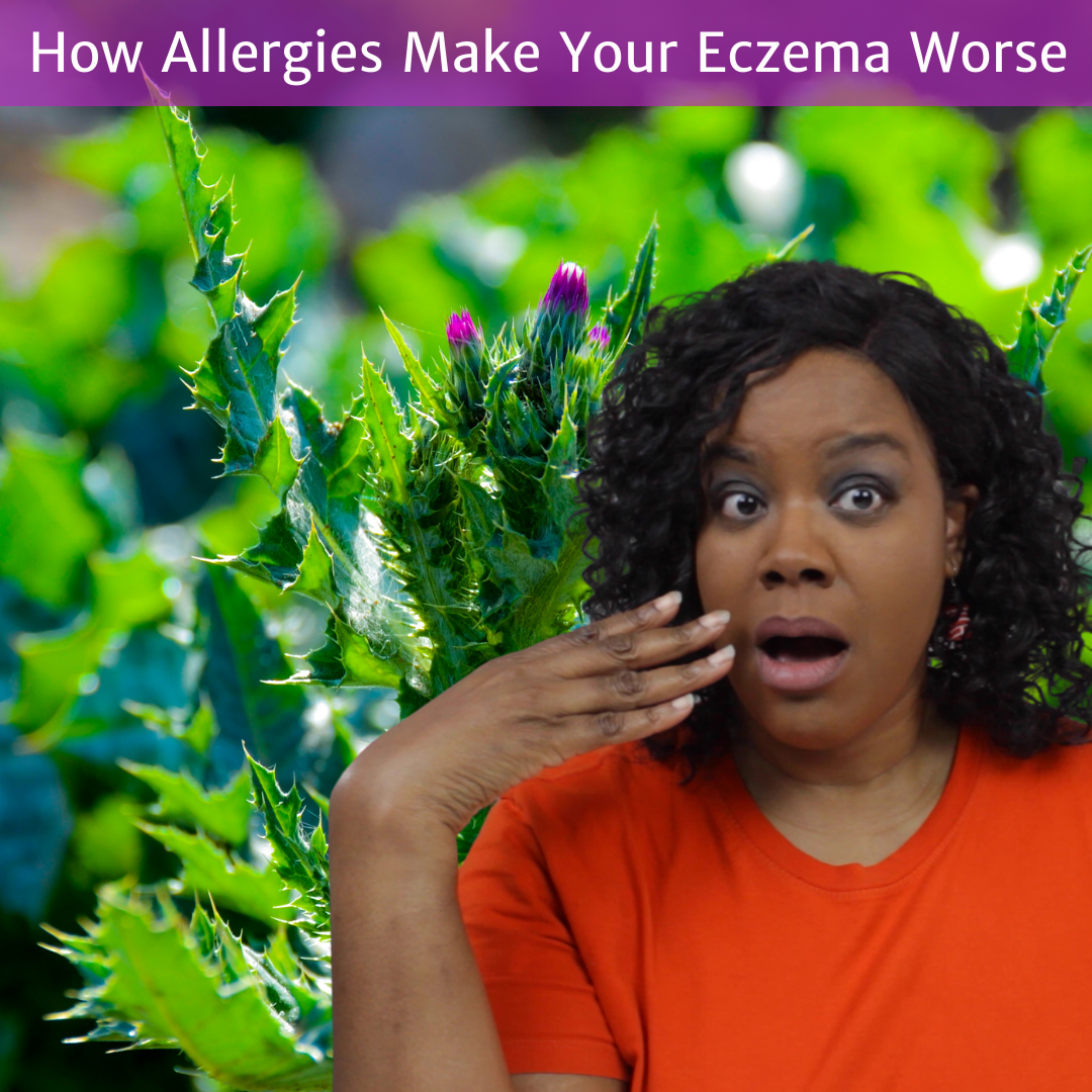 New YouTube Video: How Allergies Make Your Eczema Worse!