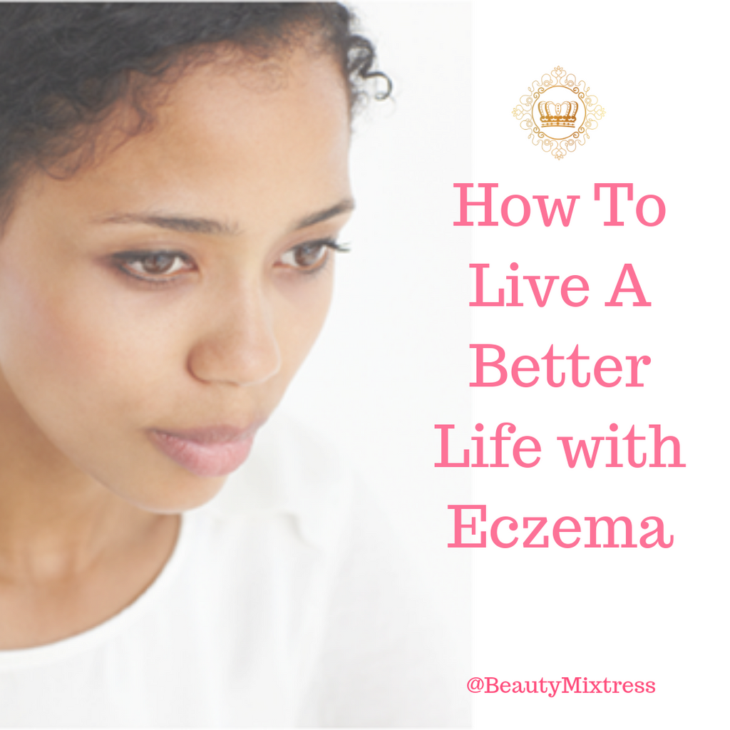 How to minimize eczema symptoms for a better life!