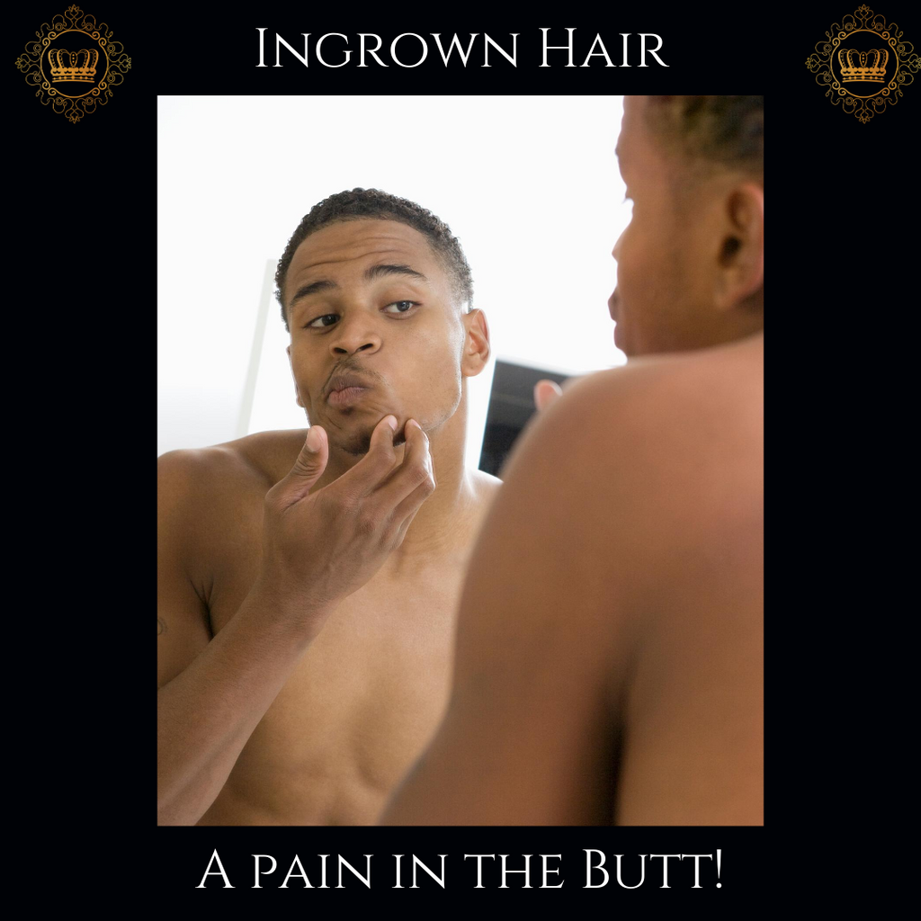 Ingrown Hairs.....a pain in the butt!🤦🏾‍♀️